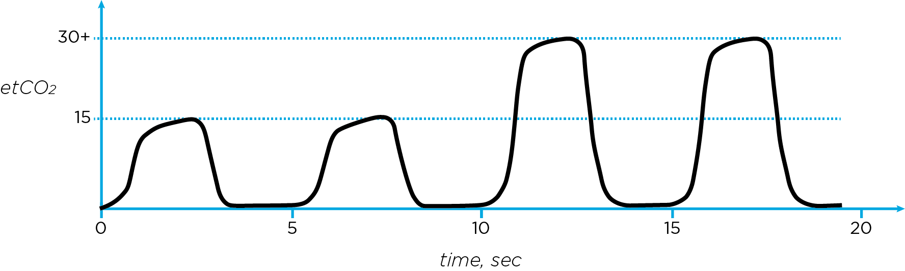 Capnography Waves