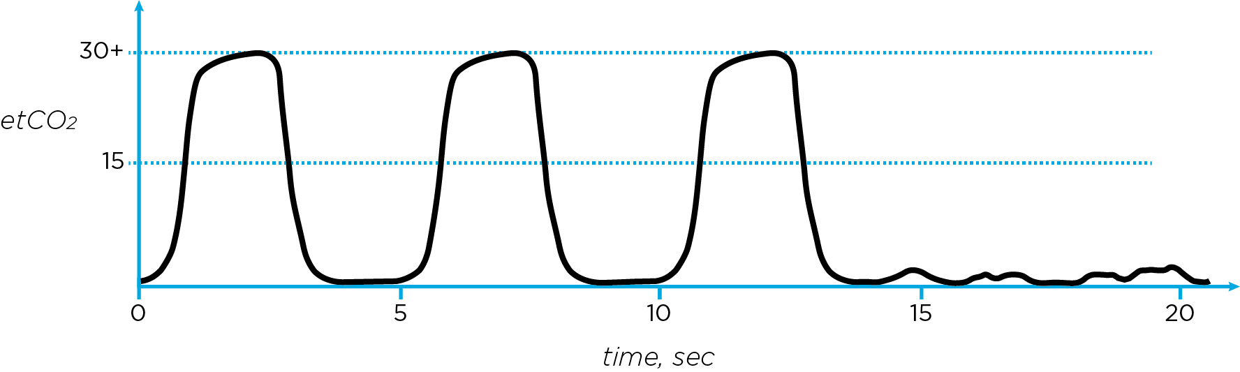 Capnography A Key Measure for Proper Airway Placement • Capsule Blog